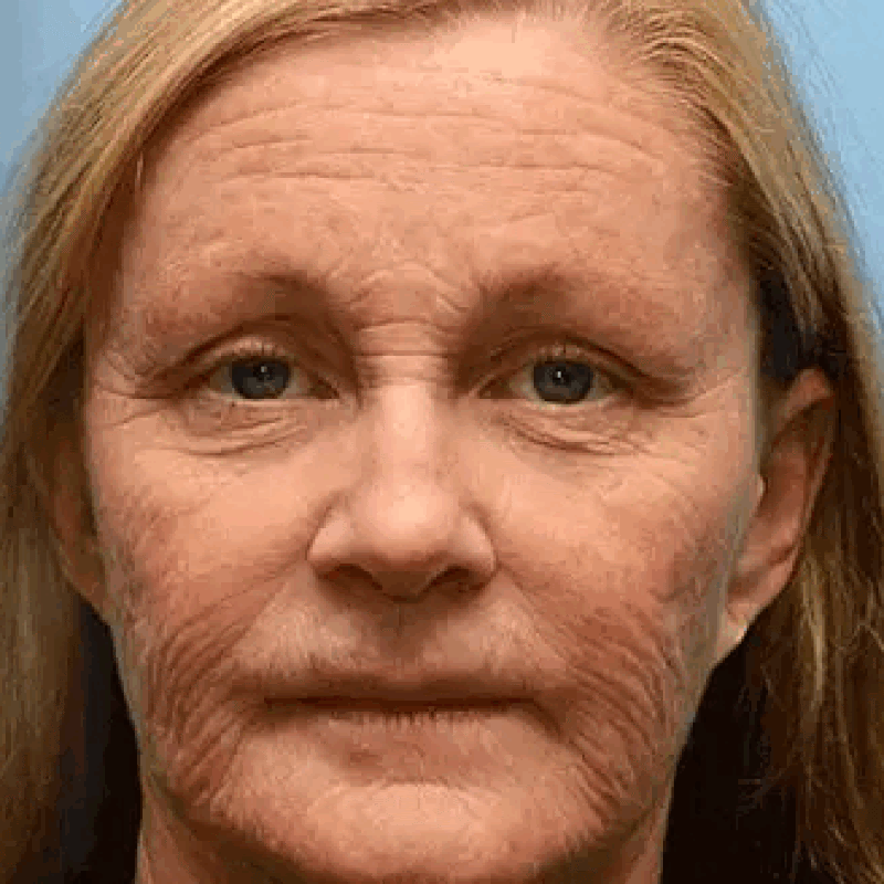 SkinFuel – Grass-Fed Tallow with Raw Honey