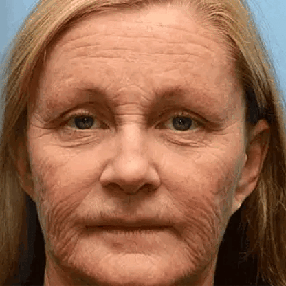 SkinFuel – Grass-Fed Tallow with Raw Honey